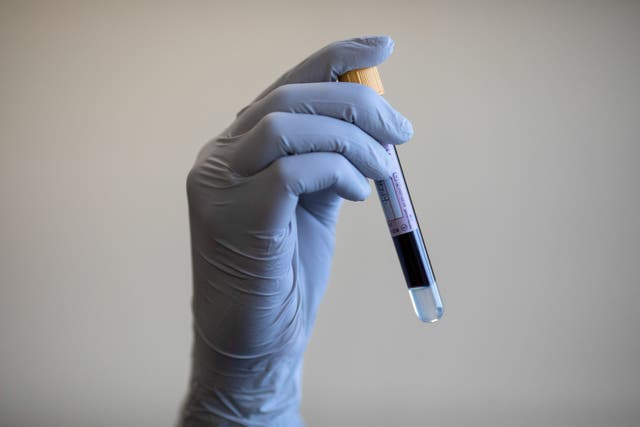 <p>A simple blood test could predict the risk of major diseases, such as cancer decades later, researchers say</p>