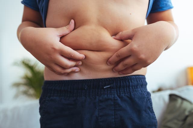 <p>Researchers warned Monday that skyrocketing obesity rates would result in an unfortunate outcome for the world’s youth. A third of children and adolescents could be overweight or obese in just 25 years</p>