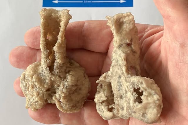 <p>3D printouts of the Palaeospondylus australis holotype, enlarged x20</p>